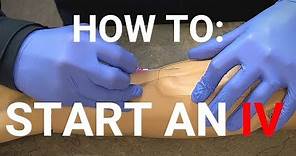 How To Start An IV