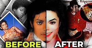 The REAL Reason Why Michael Jackson's Skin Turned White | MJ Forever