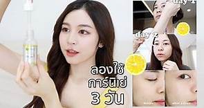 review diary / ทดลอง Garnier Booster Serum ตัวใหม่ 3 วัน! ผิวใสจริงมั้ย? | Babyjingko