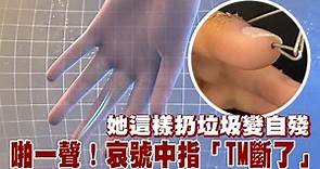 中國貴州省貴陽市一名女子這樣扔垃圾變自殘 啪一聲！哀號中指「TM斷了」 | 台灣新聞 Taiwan 蘋果新聞網