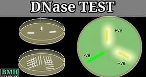 DNase Test | DNase Agar | DNA Hydrolysis Test | DNase Test For Staphylococcus aureus |