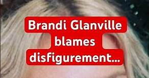 Brandi Glanville blames disfigurement…