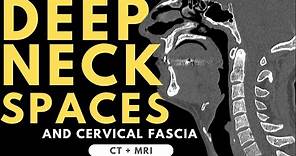 Deep neck spaces and deep cervical fascia anatomy | Radiology anatomy part 1 prep | CT and MRI