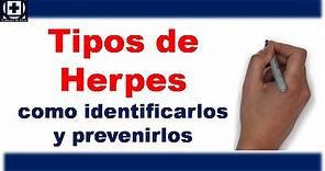 Tipos de Herpes como identificarlos y prevenirlos