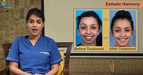 Introduction to Orthodontics-Learn the basics
