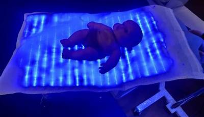 Inservice Guide Neoblue Blanket Led Phototherapy
