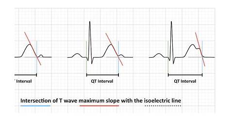 How To Measure Qtc