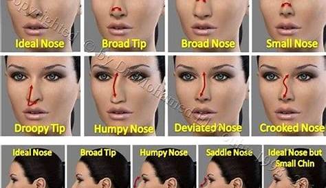 Different Types: Different Nose Types