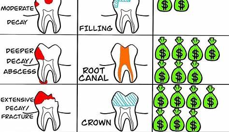 Common dental procedures.......