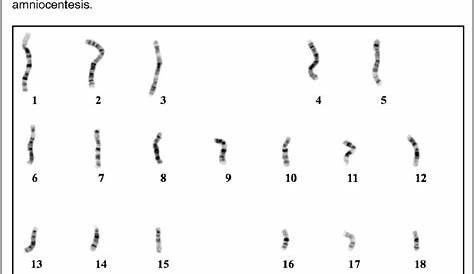 biology karyotype worksheet answer key