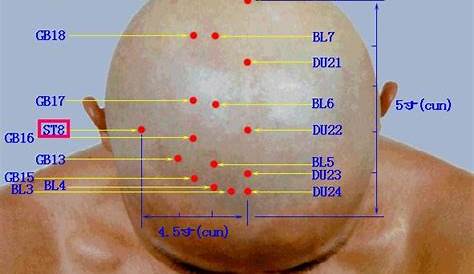 Finding the Right Acupuncturist | Acupuncture points, Accupuncture
