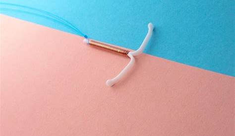 iud string color chart