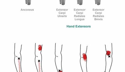 trigger point referral pain patterns for the hand & wrist Massage Tips