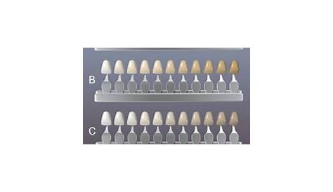 Choosing the right tooth shade - Affinity Dental Clinics