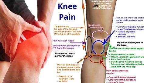 Knee pain Homeopathic treatment Right knee Left Knee by Dr Makkar