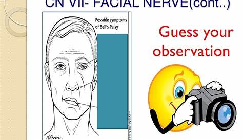 Cranial nerve assessment..Simple and Easy to perform for medics and P…