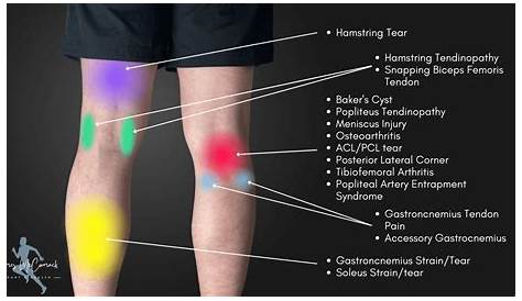 knee pain location chart knee pain