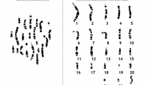 Human Karyotype Activity Worksheet | Math Worksheets Kindergarten