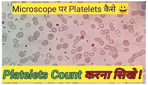 manual platelet count dog