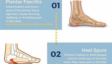 Foot pain chart: Do you know what's causing your foot pain? It may be
