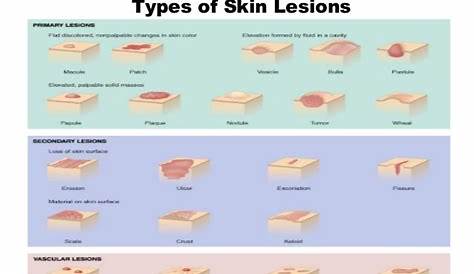 skin lesions descriptions - pictures, photos