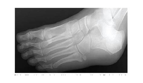 diagnosis of heel pain