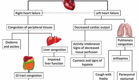 Right-Sided Heart Failure S S | left sided heart failure – Google