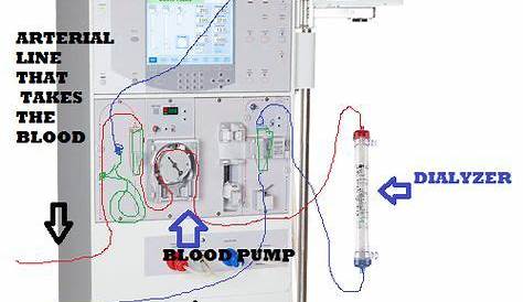 dialysis machine parts and functions pdf