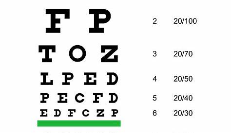 Common Types of Eye Examinations | Arizona RETINA Project