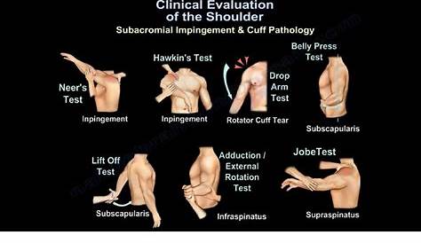Clinical Evaluation of the Shoulder — OrthopaedicPrinciples.com