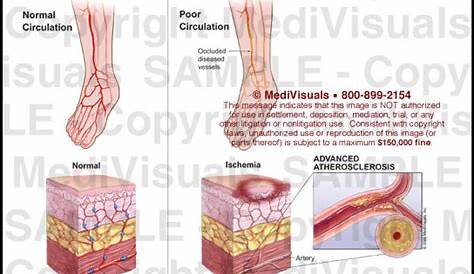 vascular skin lesions chart