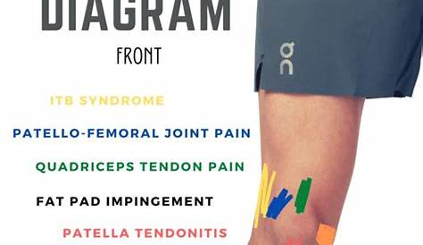 front knee pain chart
