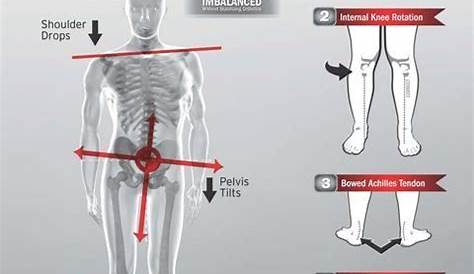 front knee pain chart