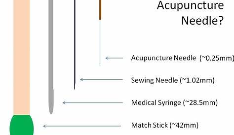 About Acupuncture Treatment – BURNABY ACUPUNCTURE | TCM AND SPIRITUAL