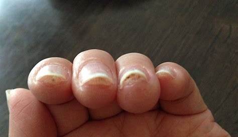 爪 ネイル 痛み 【ジェルオフ後】に付いた白い傷を取る方法 YouTube