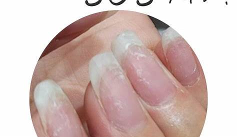 爪が白くなってしまう3大原因と対処法｜マニキュア、ネイルカラー、ネイルケア