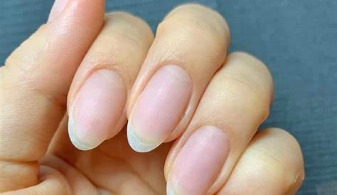 爪 ピンクのところ 白い の部分が増える5つの原因と対策をわかりやすく解説します