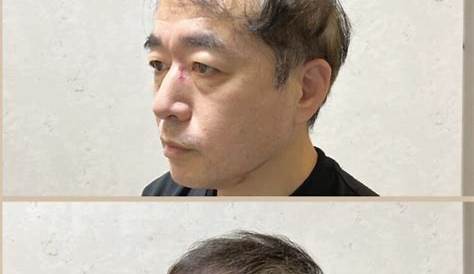 髪型 メンズ 丸 顔 薄毛 ぜいたく 絶壁