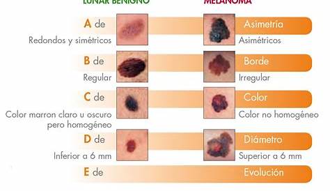 ¿Qué significado tienen los lunares que producen picor?