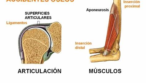 Accidentes oseos - ACCIDENTE DESCRIPCION EJEMPLO IMAGEN Fisura