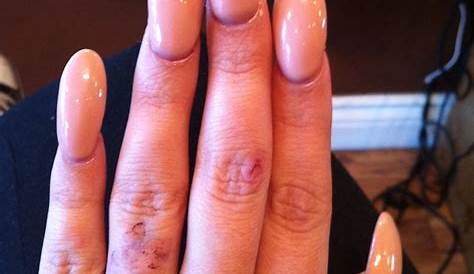 Bad Acrylic Manicure Goes Viral NewBeauty