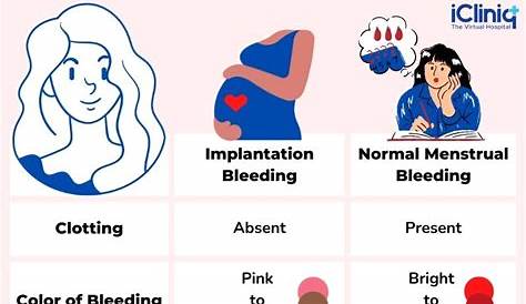 Am I Pregnant Implantation Bleeding Quiz mplantation What t s And What