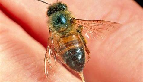 Unveiling The Enigma Of Anoxic Bee Stings: Discoveries And Insights