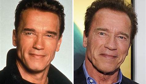 Arnold Schwarzenegger's Plastic Surgery: Unveiling Hollywood's Secrets