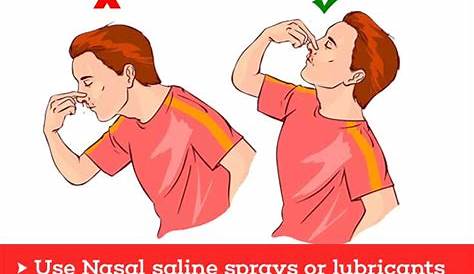 Having A Nosebleed? Here's A Guide On How To Stop And Prevent It | Stop