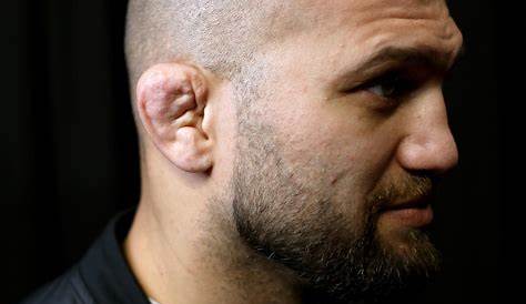 Cauliflower Ears Photos and Premium High Res Pictures - Getty Images