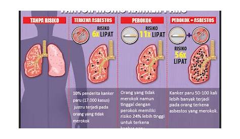 Ciri-Ciri Paru-Paru Sehat, Salah Satunya Dapat Menarik Napas Panjang