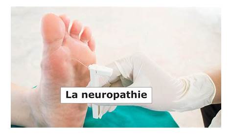 La Neuropathie Périphérique Remède Naturel Est Un Excellent Produit