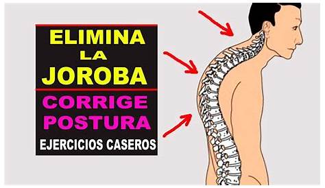 CÓMO QUITAR LA JOROBA DESDE LA CASA/ CORREGIR LA POSTURA/ ENDEREZAR LA