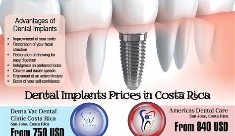 Dentist in Costa Rica (Best place for Dental Implants in San Jose